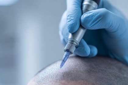 Haarpigmentierung Hannover für Männer und Frauen